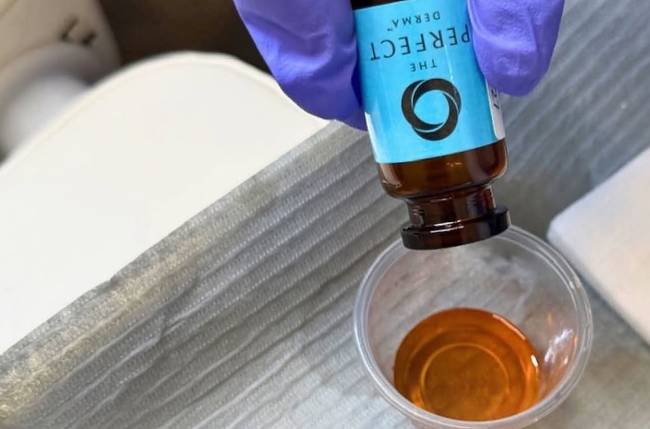 Chemical Peels Waterloo