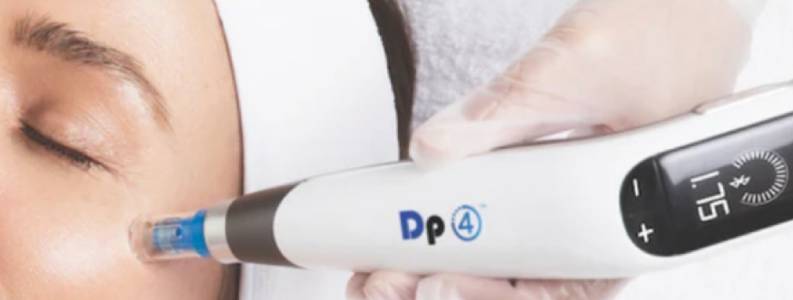 Microneedling Treatment in Kitchener-Waterloo