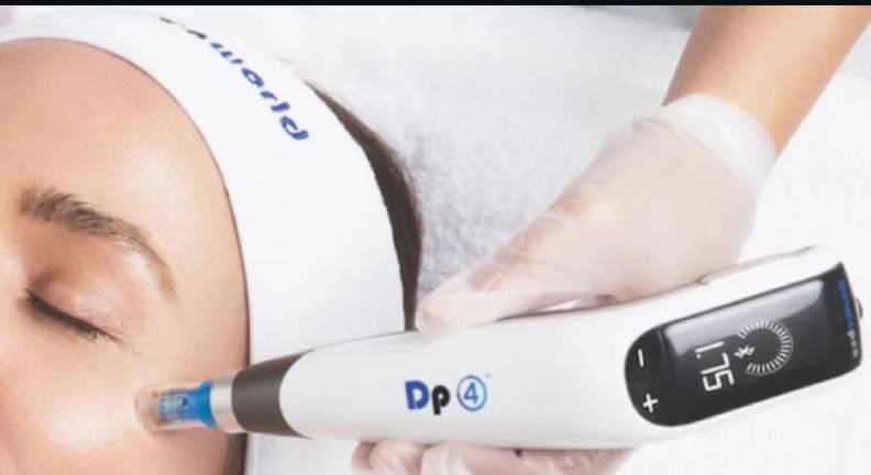 Microneedling Kitchener